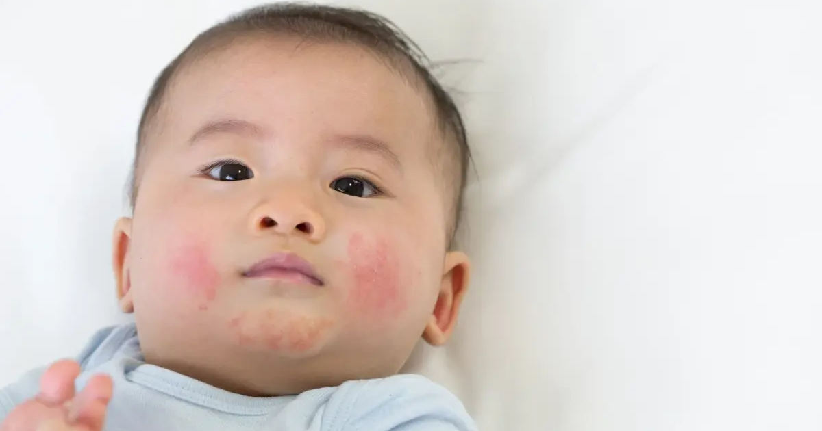 Jak pielęgnować wrażliwą skórę dziecka? Kompleksowy przewodnik dla rodziców